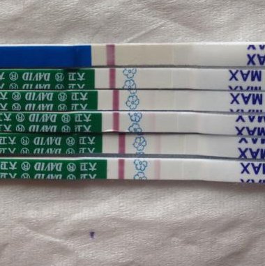 什么是假性怀孕？假性怀孕有哪些症状