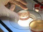 做试管婴儿有多“遭罪”？一篇漫画阐明全部流程，看完泪目了